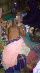 Dua Warga Terang Bulan Tewas Disambar Petir