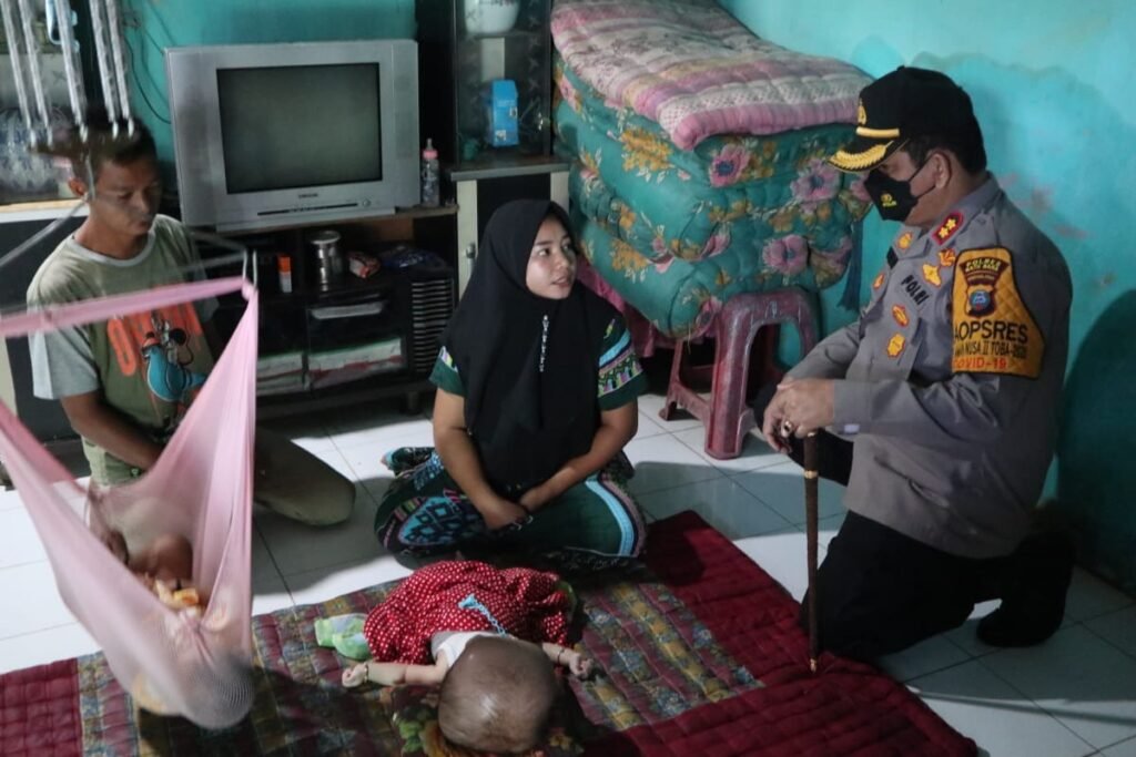 Kapolres Batubara Beri Bansos Penderita Hidrosefalus di Desa Bagan Dalam