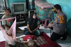 Kapolres Batubara Beri Bansos Penderita Hidrosefalus di Desa Bagan Dalam